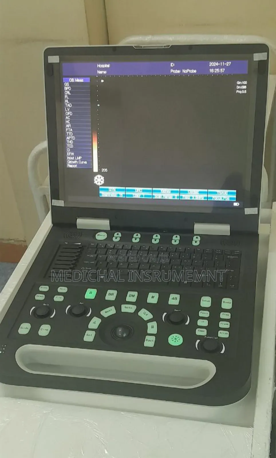 Sonostar Ultrasound Machine