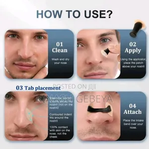 Nasal Dilator(የአፍንጫ መተንፈሻ ቀዳዳ ማስተካከያ)