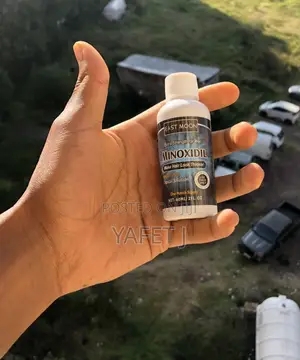 Photo - East Moon Minoxidil and Darma Roller