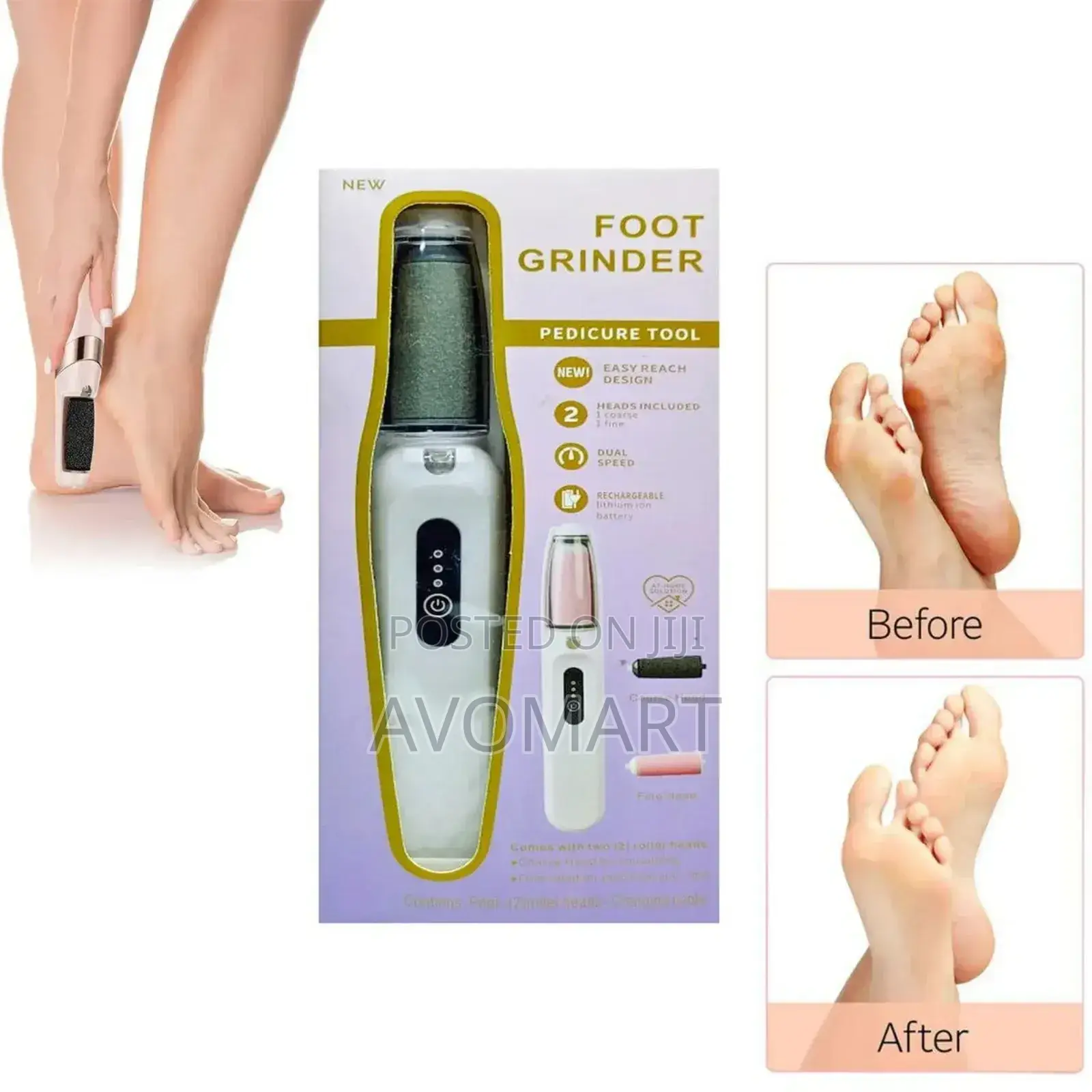 Foot Grinder