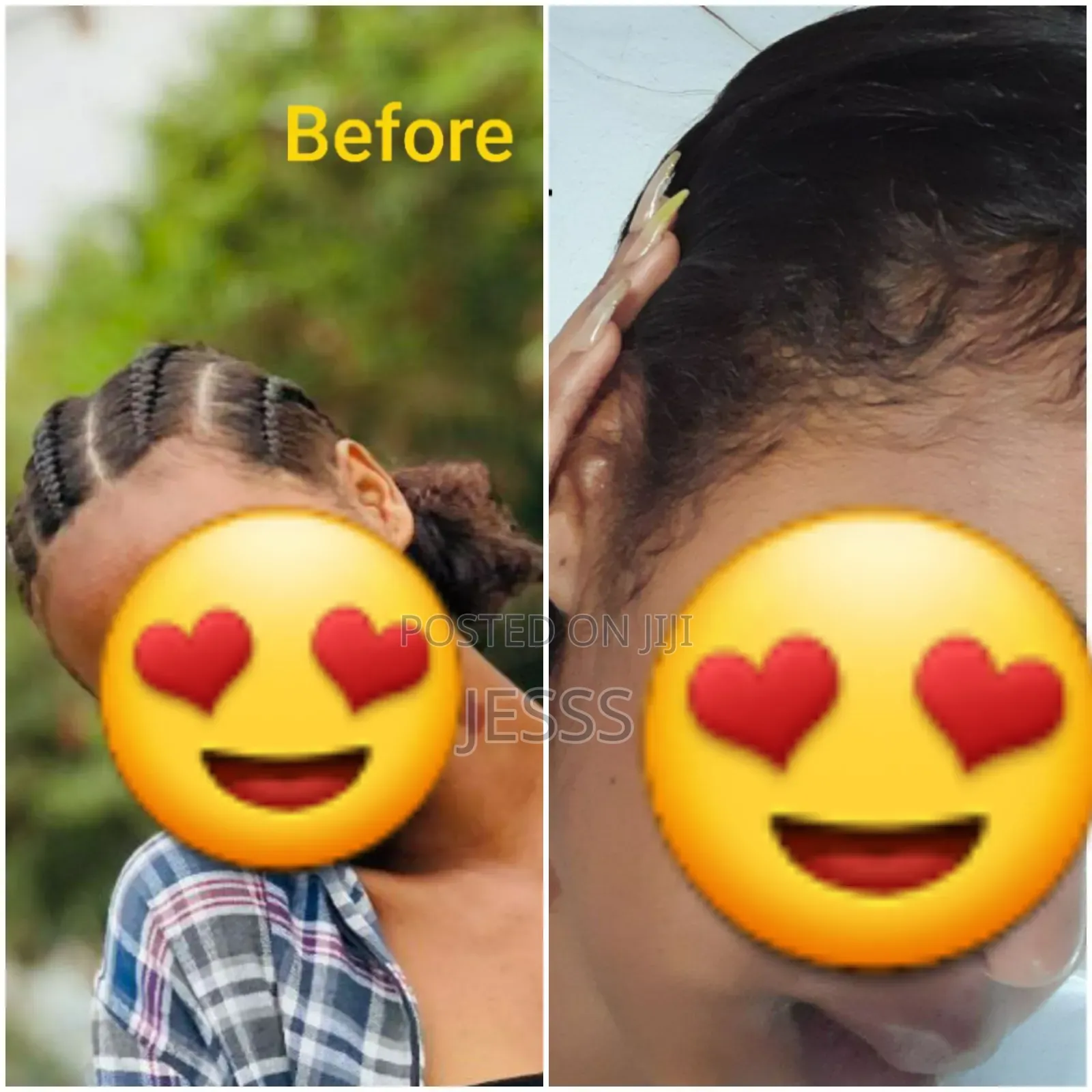 Kirkland Minoxidl 5% Original