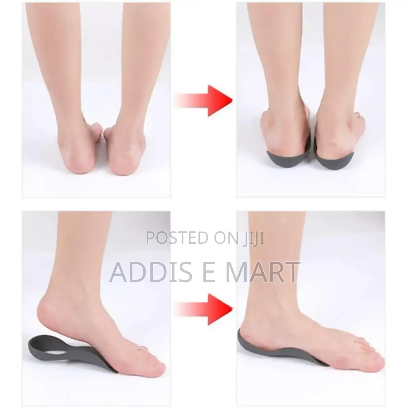 Arch Support Orthopedic Insoles