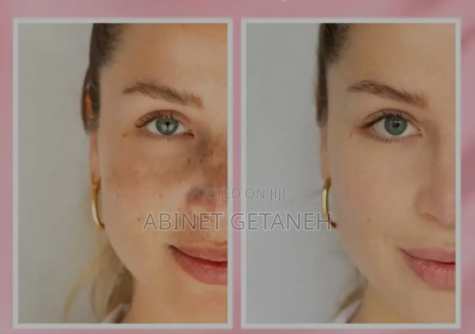 Eucerine Anti Pigment