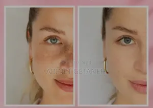 Eucerine Anti Pigment