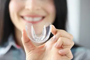 Teeth Alignment Rteoll
