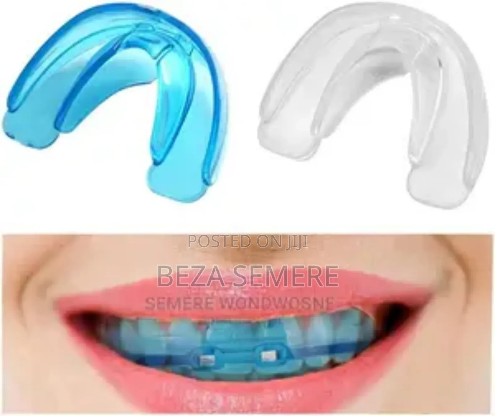 Teeth Alignment Qulitimn