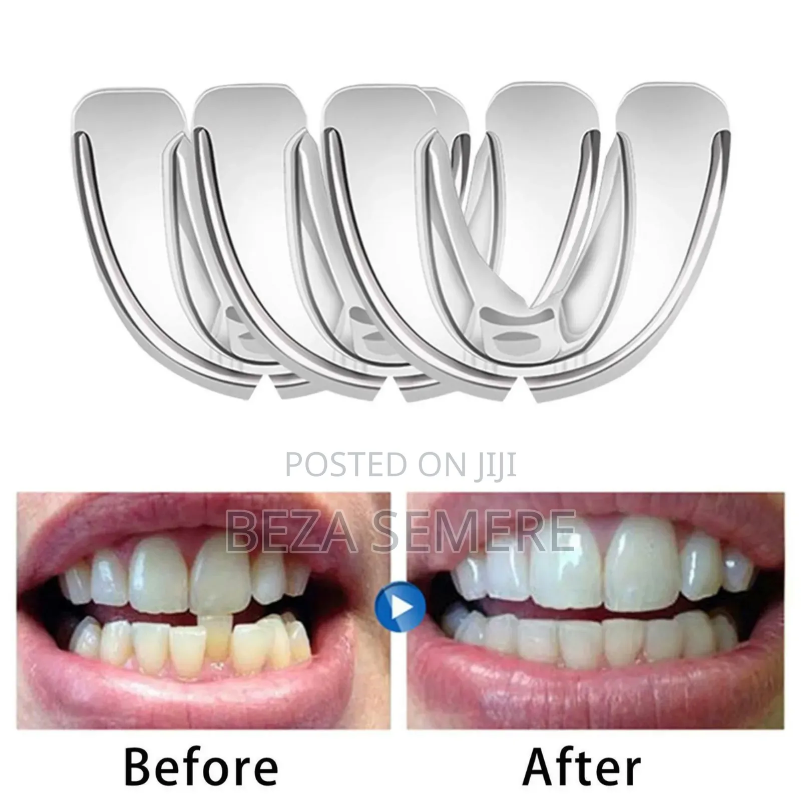 Teeth Alignment Qizzk