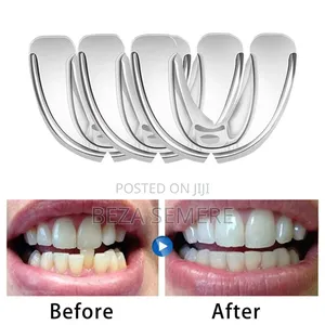 Teeth Alignment Qizzk
