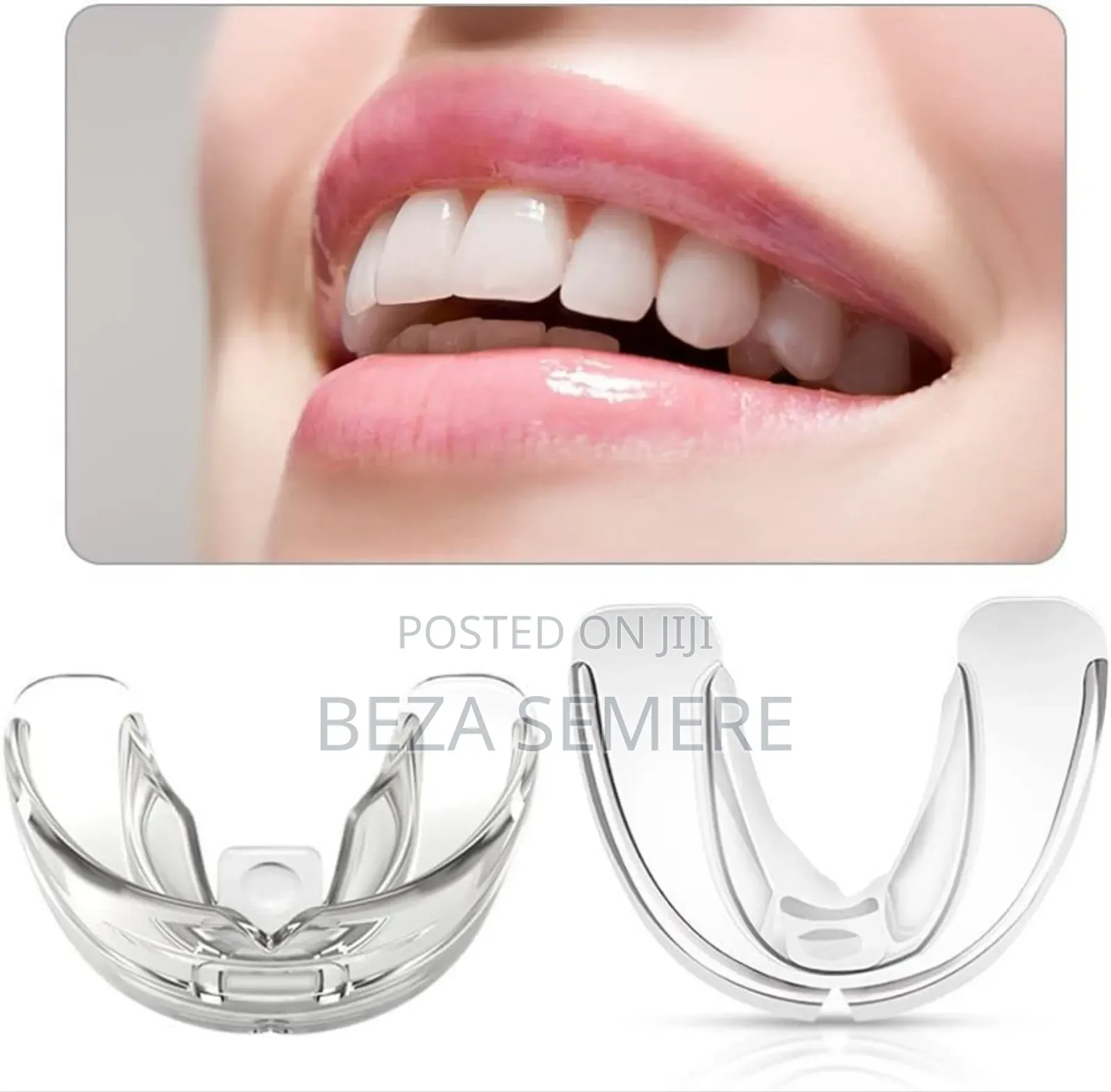 Teeth Alignment Qizzk