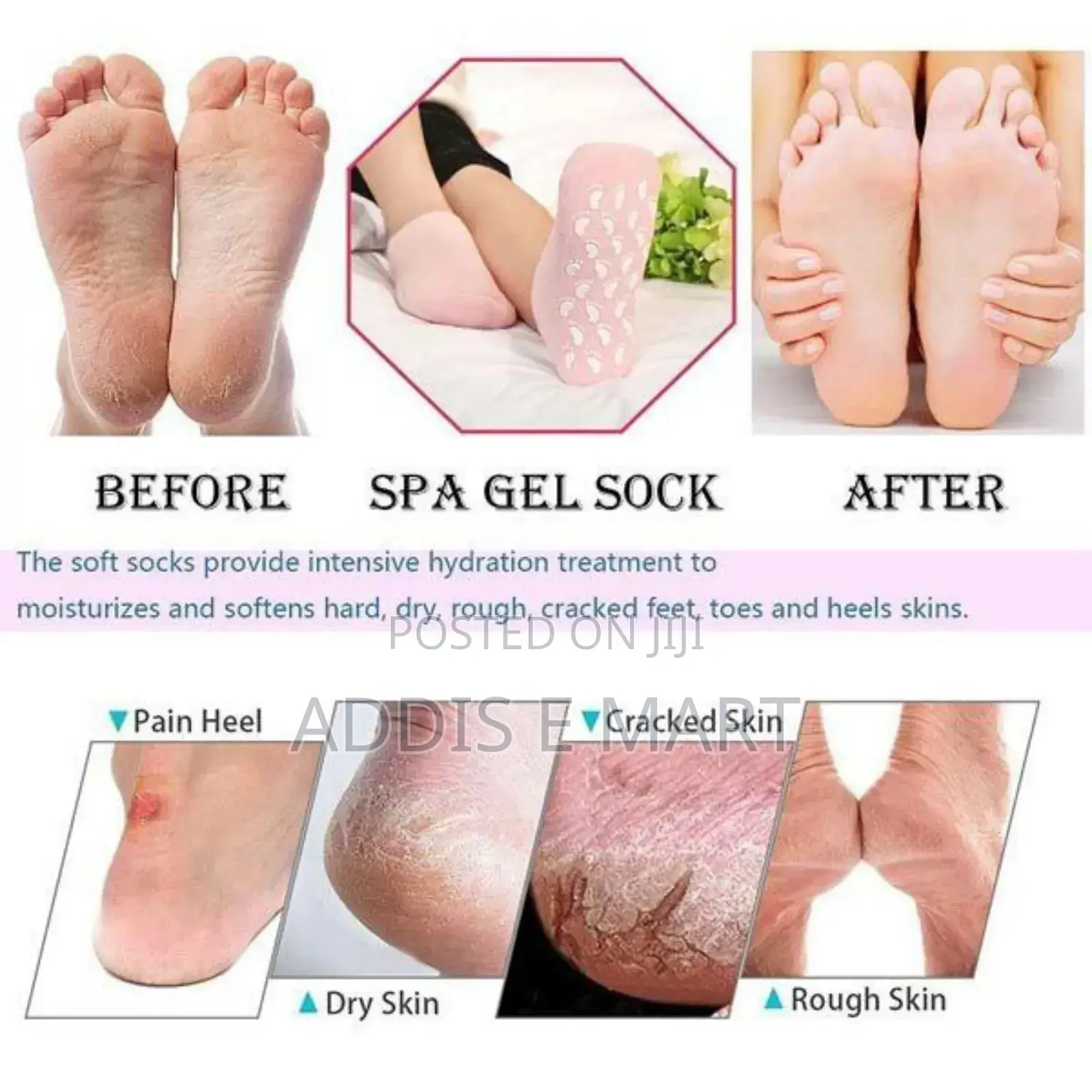 Soft Moisturizing Gel Socks Foot Care