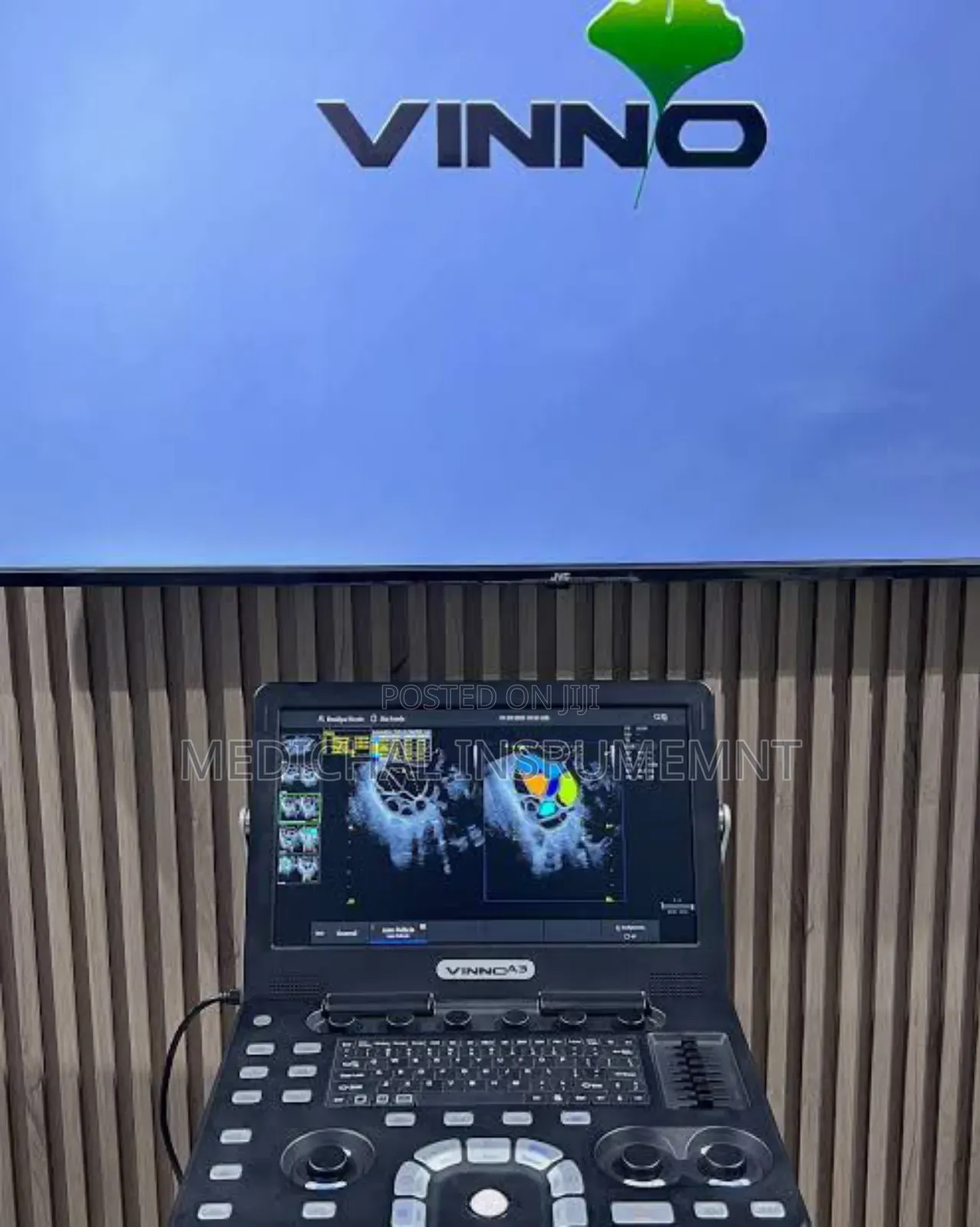 Vinno Doppler Ultrasound Machine