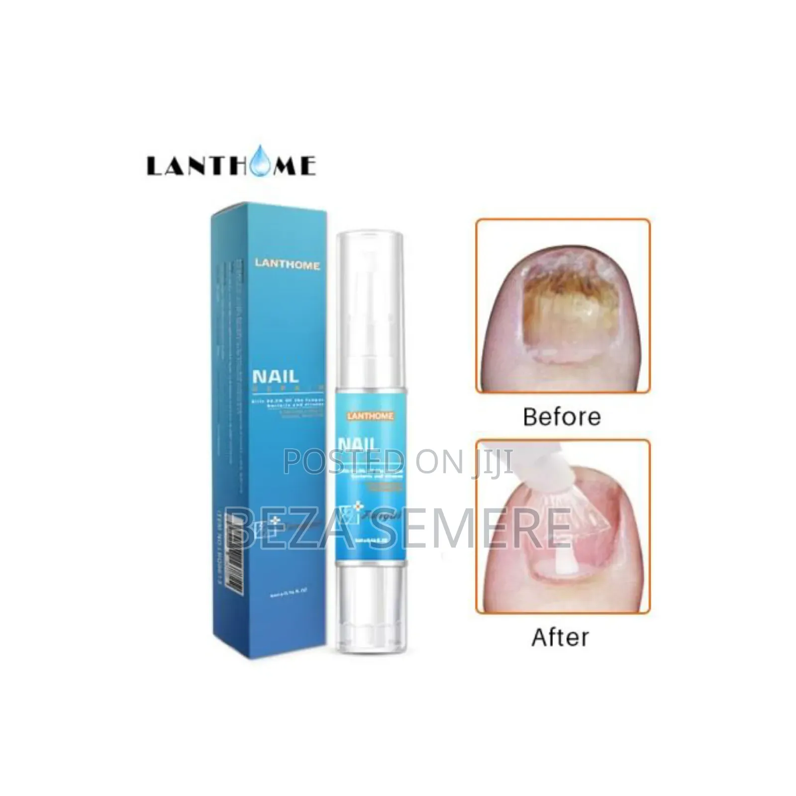 Lanthome Nail Repair Zikodin