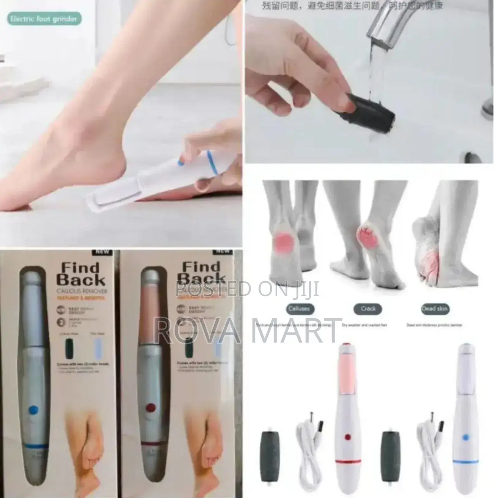Find Back Callous Remover