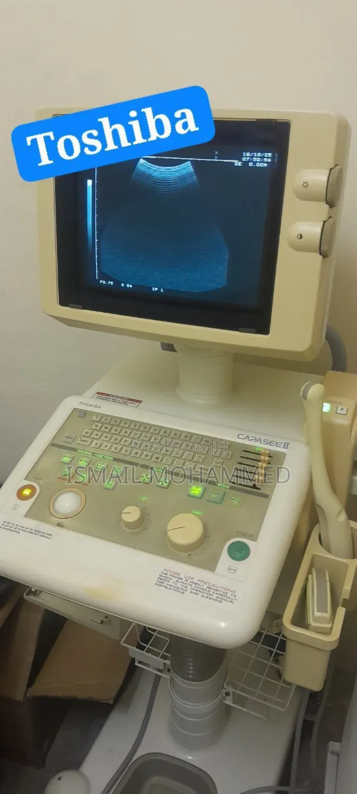 Toshiba Ultrasound