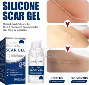 Photo - Scar Removal