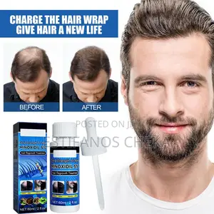 Photo - Minoxidil Kirkland