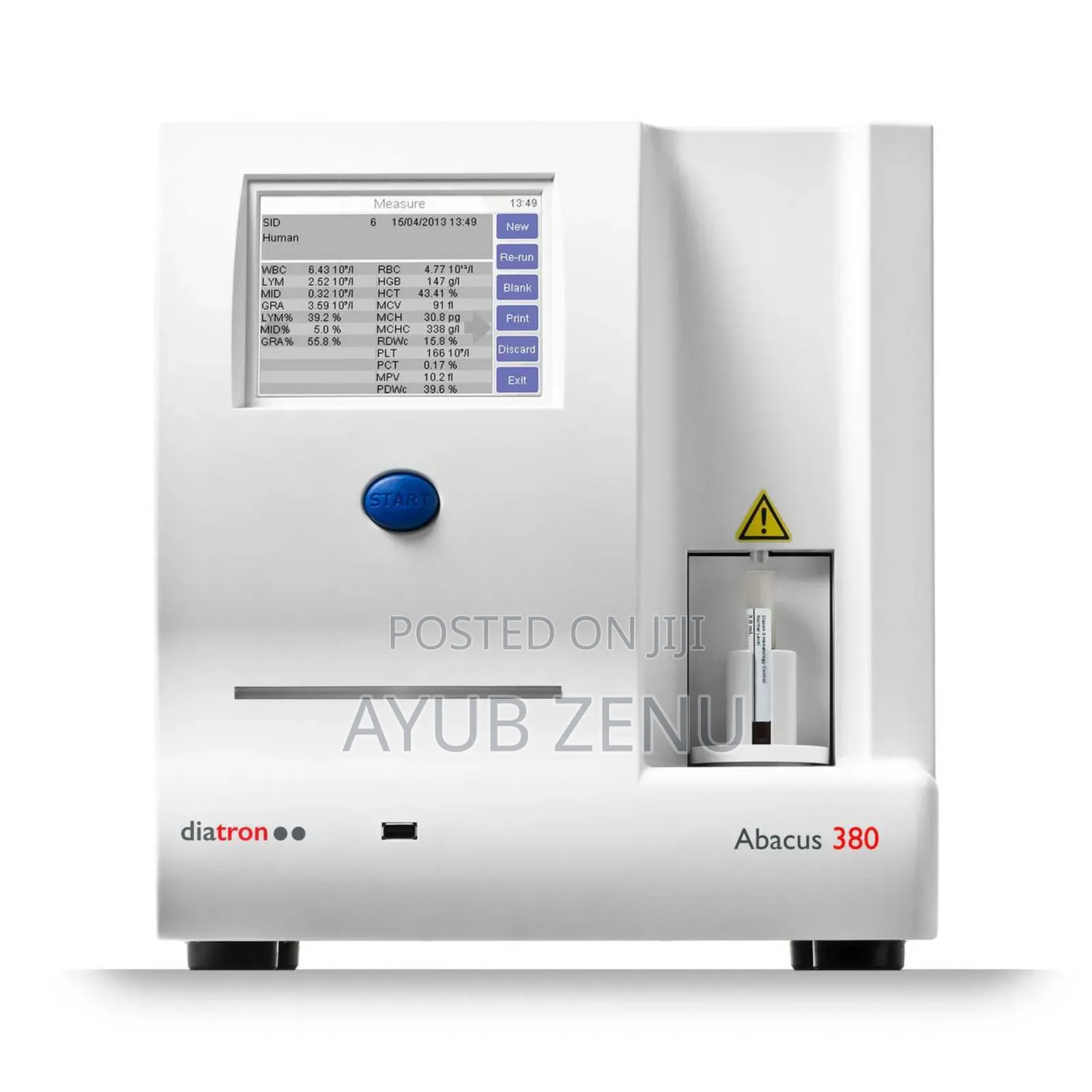 CBC Machine, Abacus 380