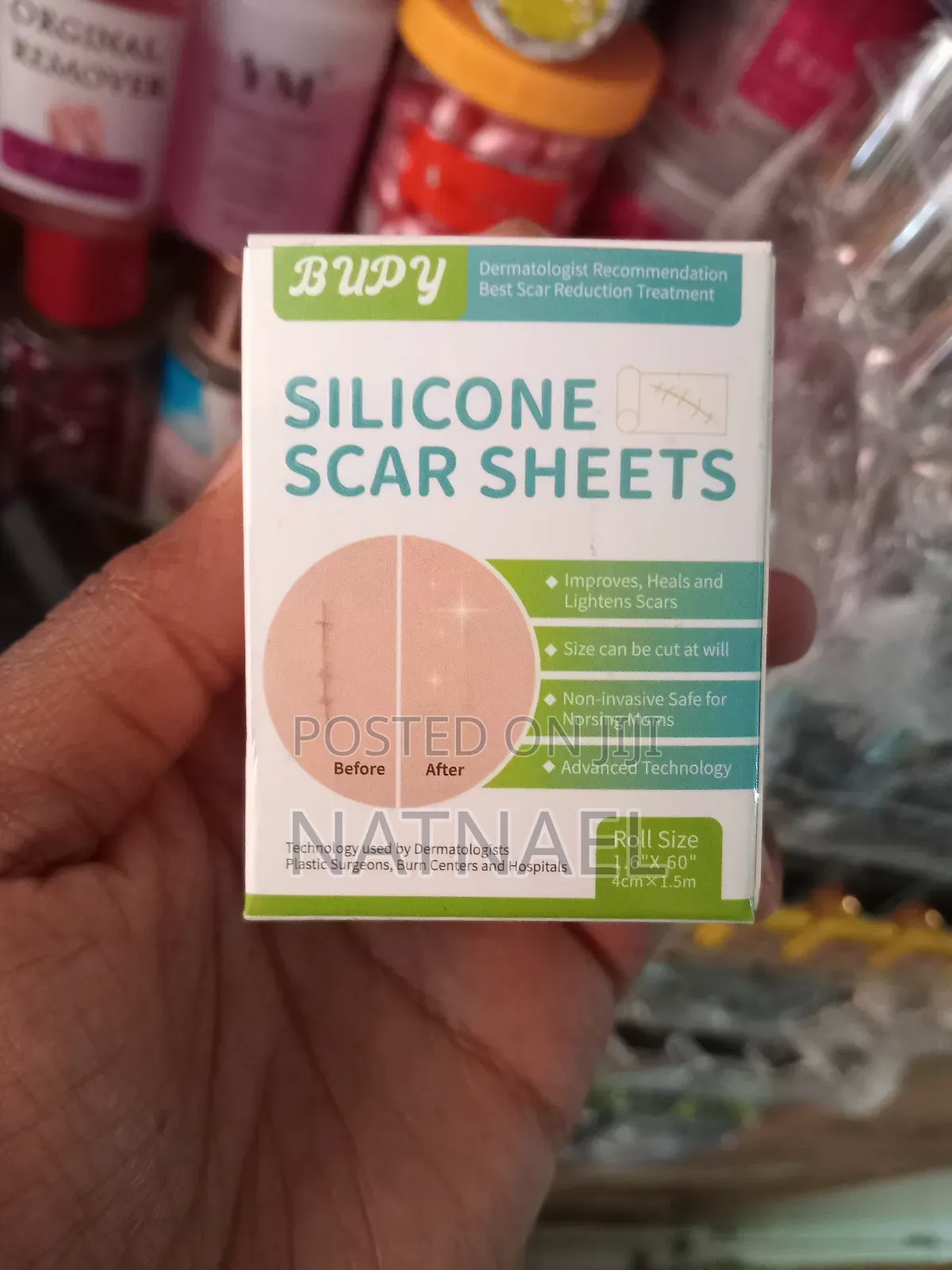 Silicone Scar Sheets