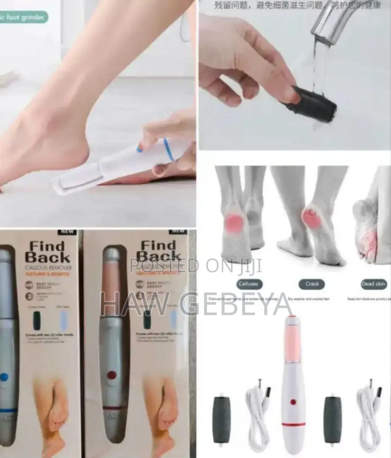 Find Back Callous Remover