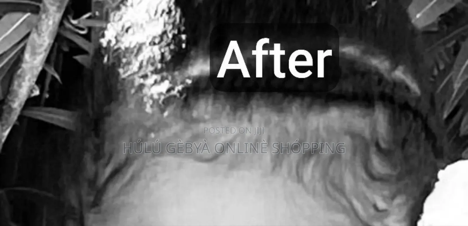 Hair Growth Minoxidil