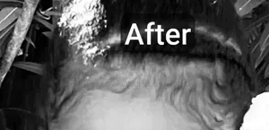 Hair Growth Minoxidil