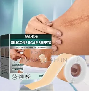 Photo - Silicone Scar Sheets