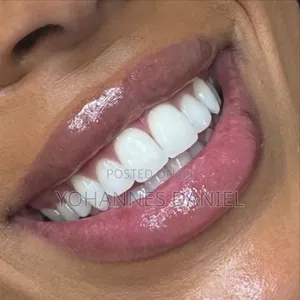 Teeth Whitening Mint