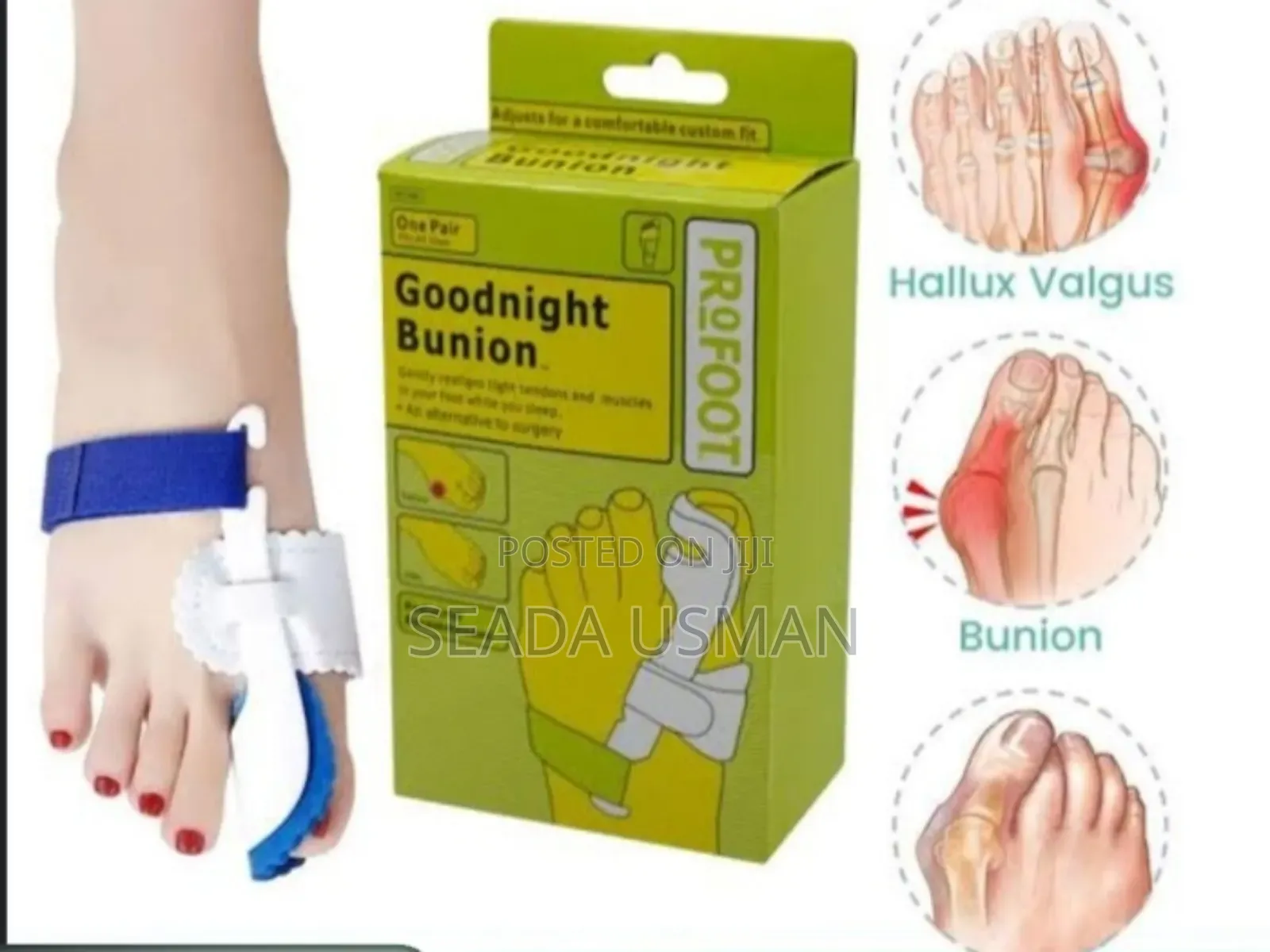 የአውራ ጣት ማስተካከያ(Bunion Corrector)