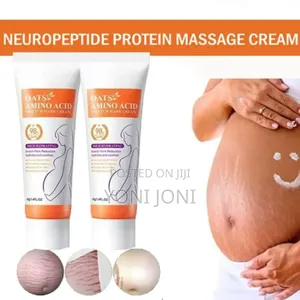 Stretch Mark Removal Cream