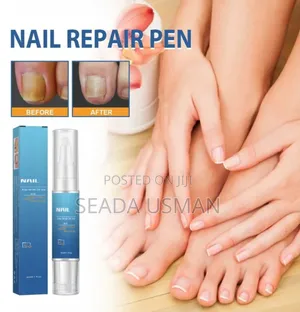 Photo - የጥፍር ማስተካከያ (Lanthome Nail Repair)