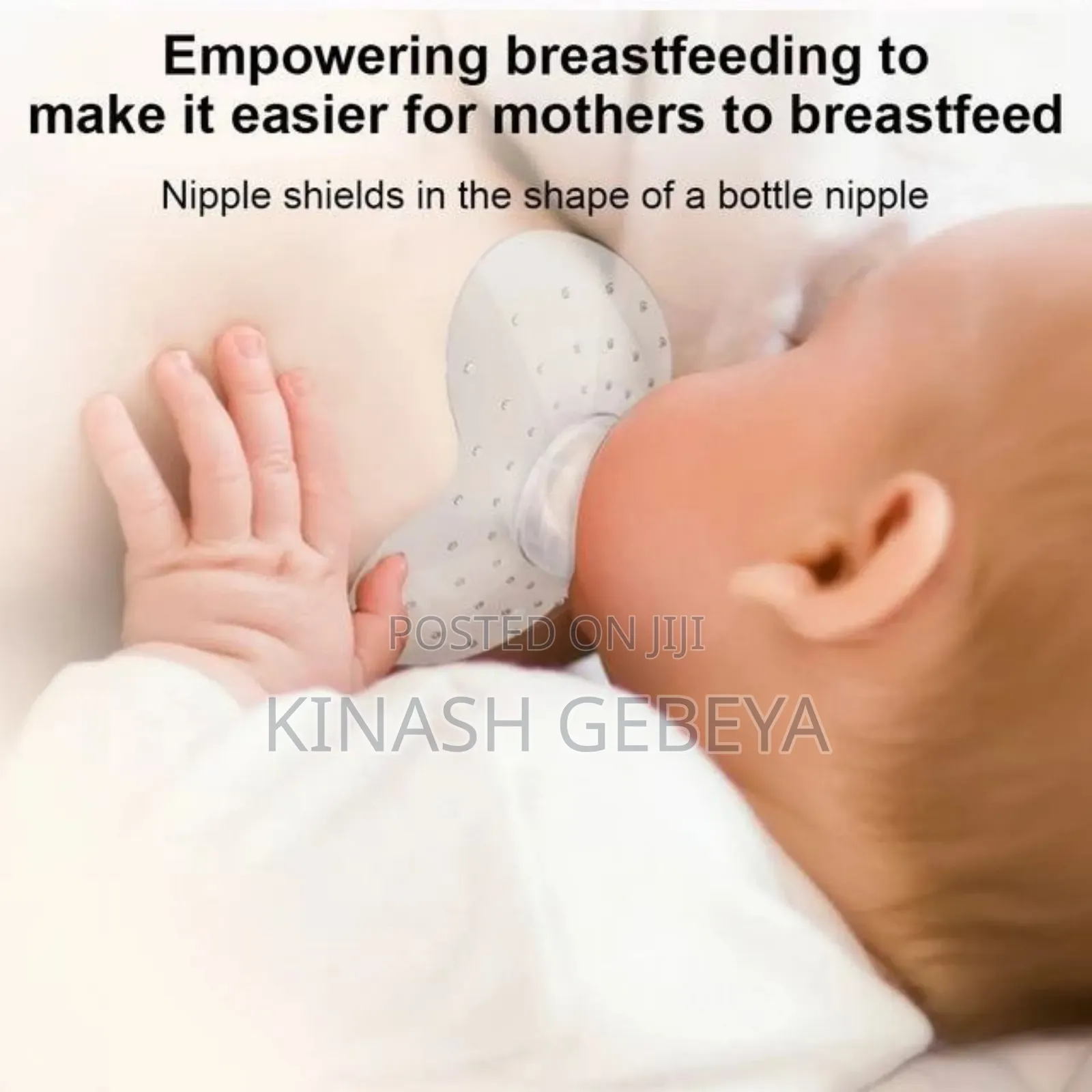 Nipple Replacement(የእናት ጡት ጫፍ ማራዘሚያ)
