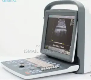 Photo - Chison Echo 2 Ultrasound Machine
