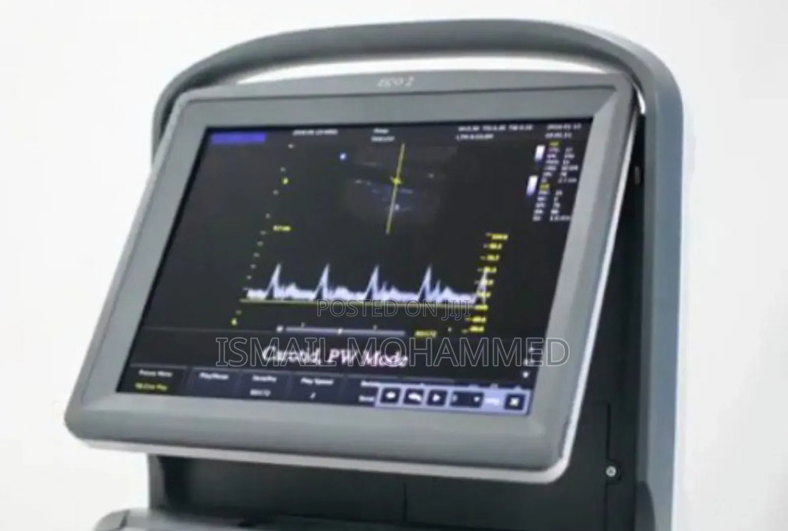 Chison Echo 2 Ultrasound Machine