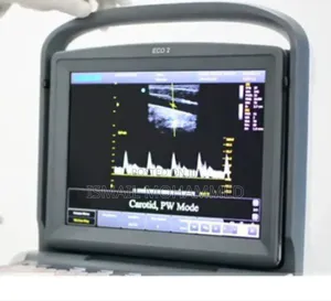 Chison Echo 2 Ultrasound Machine