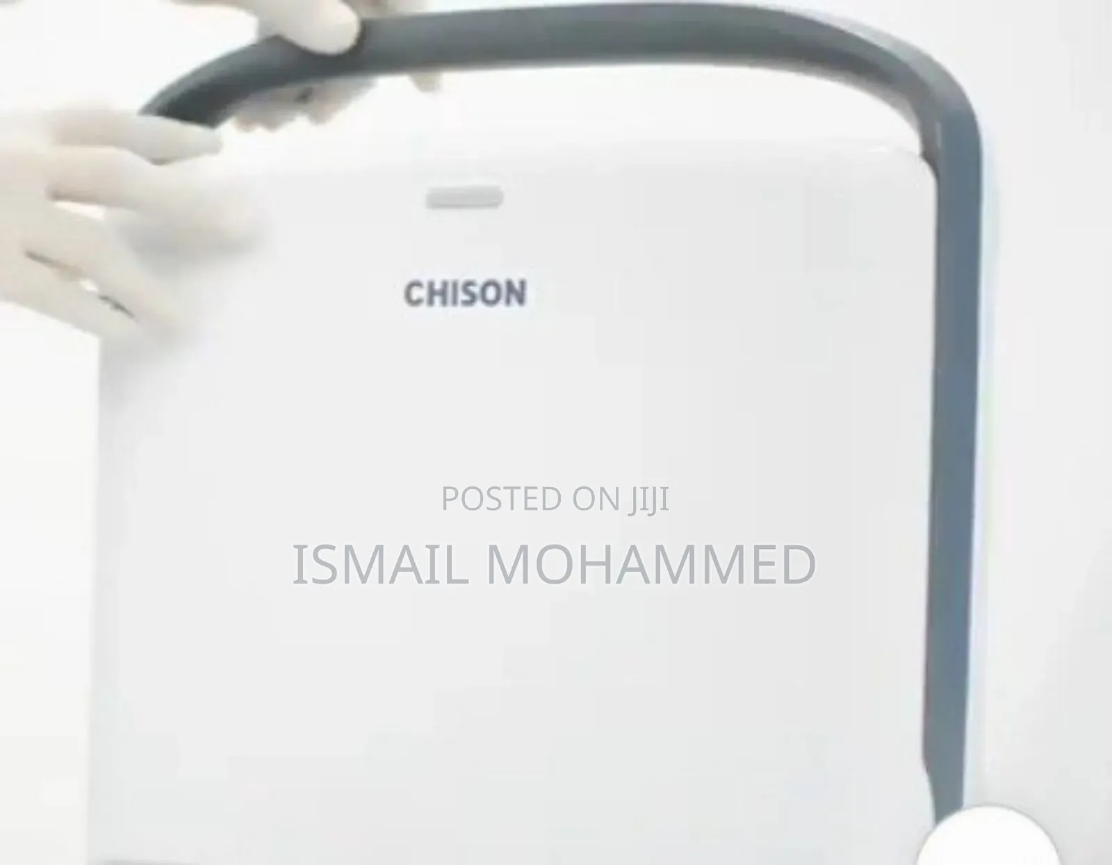 Chison Echo 2 Ultrasound Machine