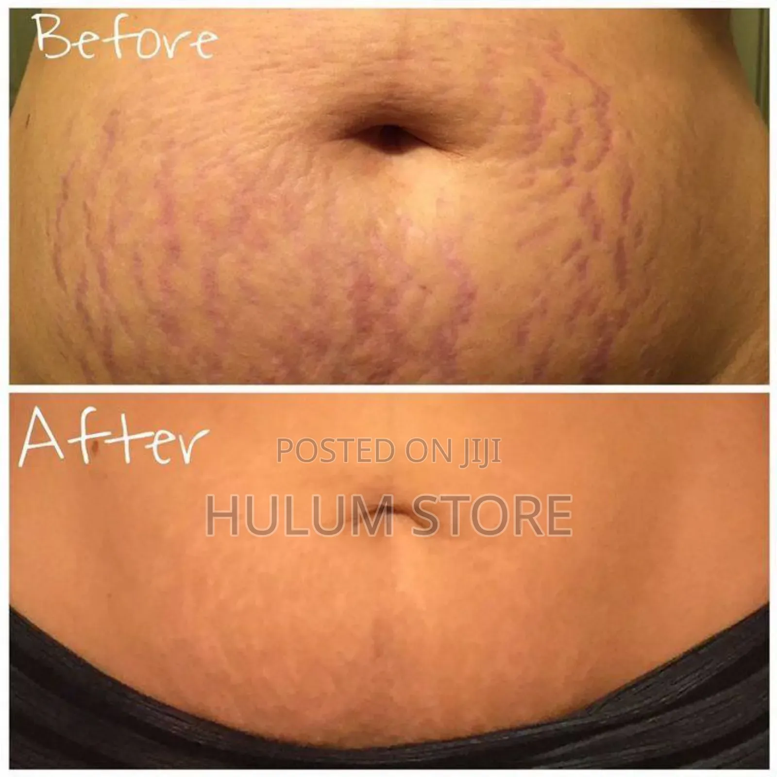 Palmer's Cocoa Butter Formula Massage Lotion for Stretch Marks