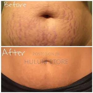 Palmer's Cocoa Butter Formula Massage Lotion for Stretch Marks