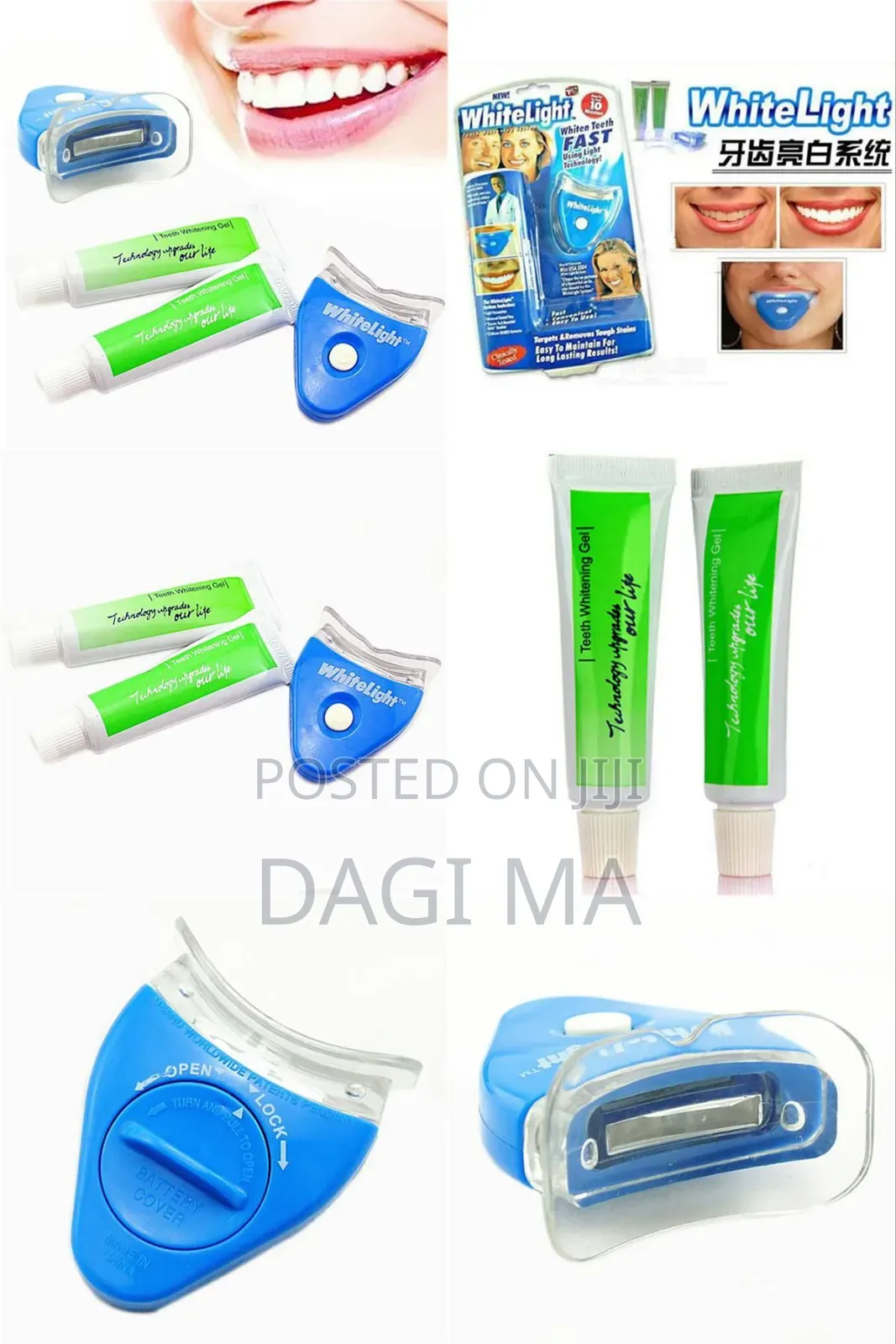 Dental Uv Teeth Whitener(ጥርስ ማንጫ)