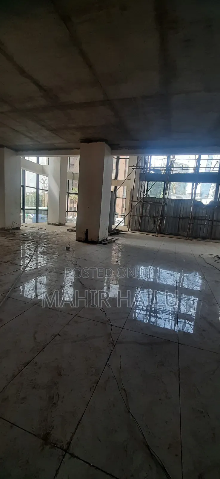 1ኛ ላይ ነው ለጥርስ ህክምና ለቢሮ ይቻላል