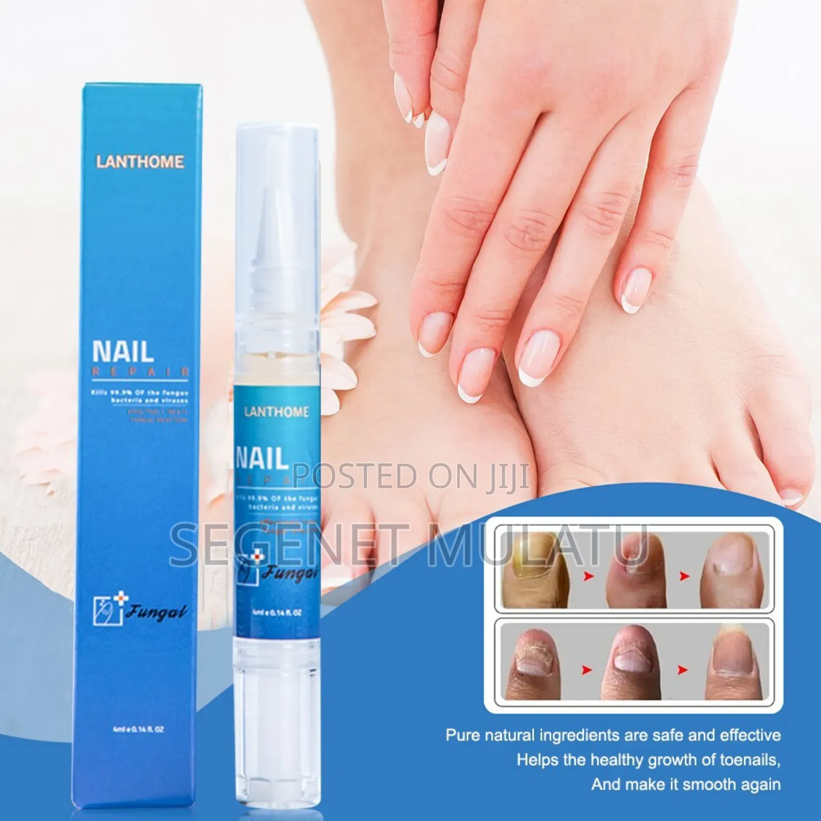 ለጠቆረ, ለበለዘ, የማደግ አቅም ላነሰው ጥፍር