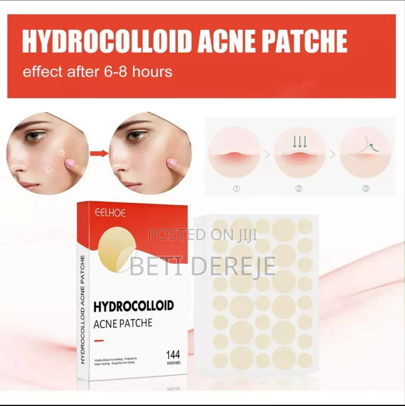 Hydrocolloid Acne Pimple Patch