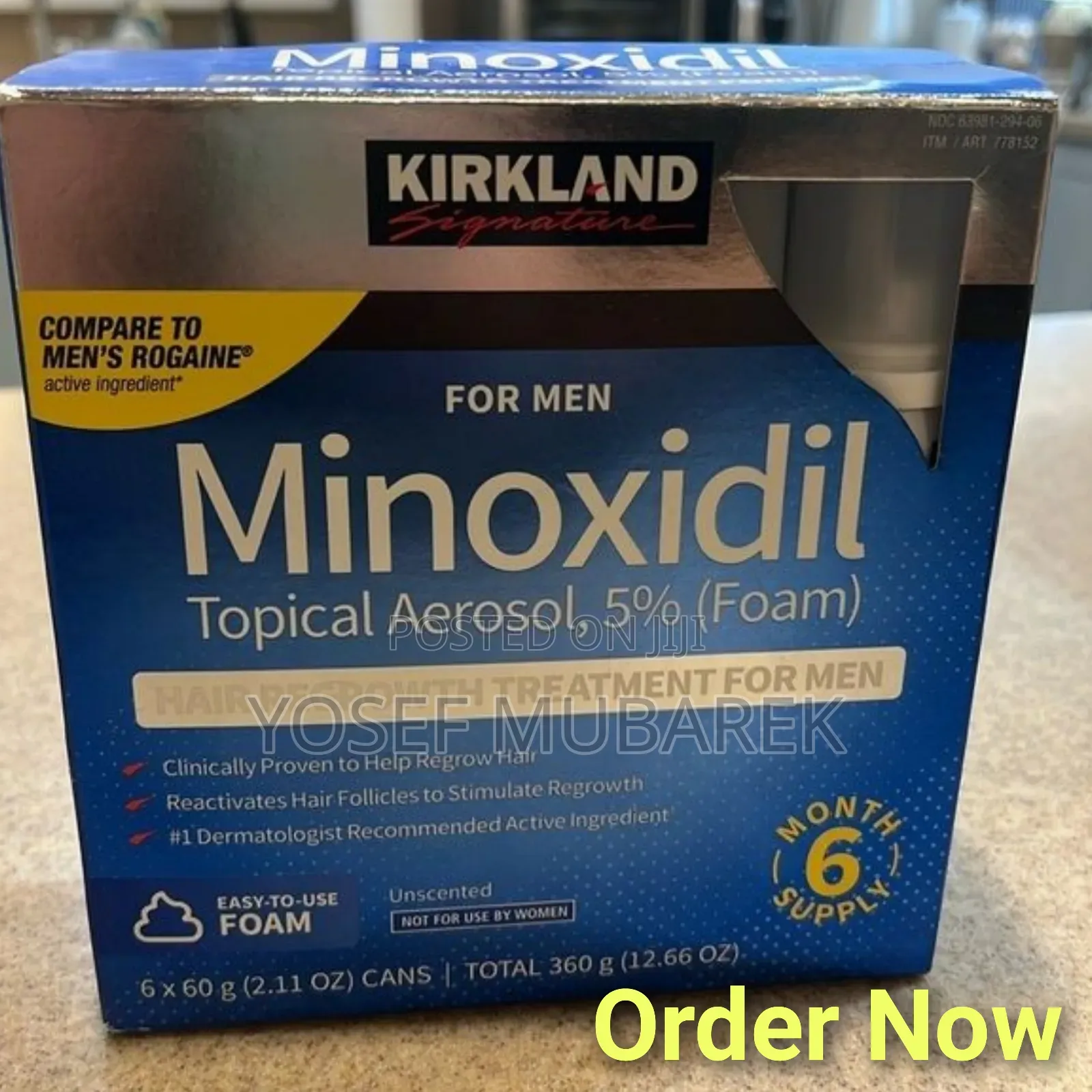Hair Transplant£¢Minoxidil Kirkland„£¶£√