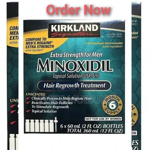 Hair Transplant£¢Minoxidil Kirkland„£¶£√