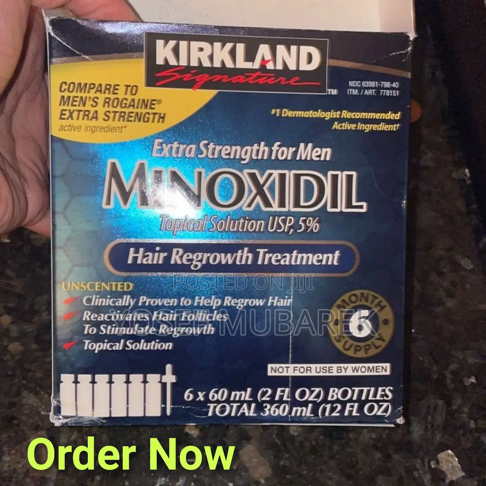 Healing *#HairKirkland Minixidil